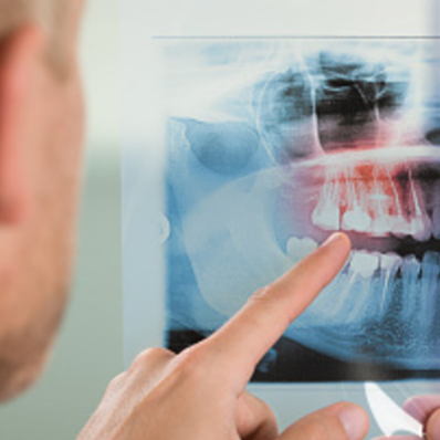 dental xray service