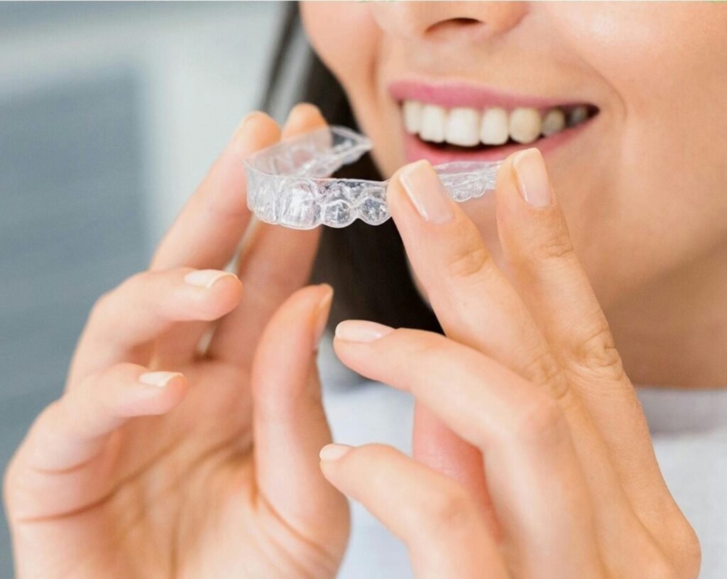 Clear Aligners Near Me